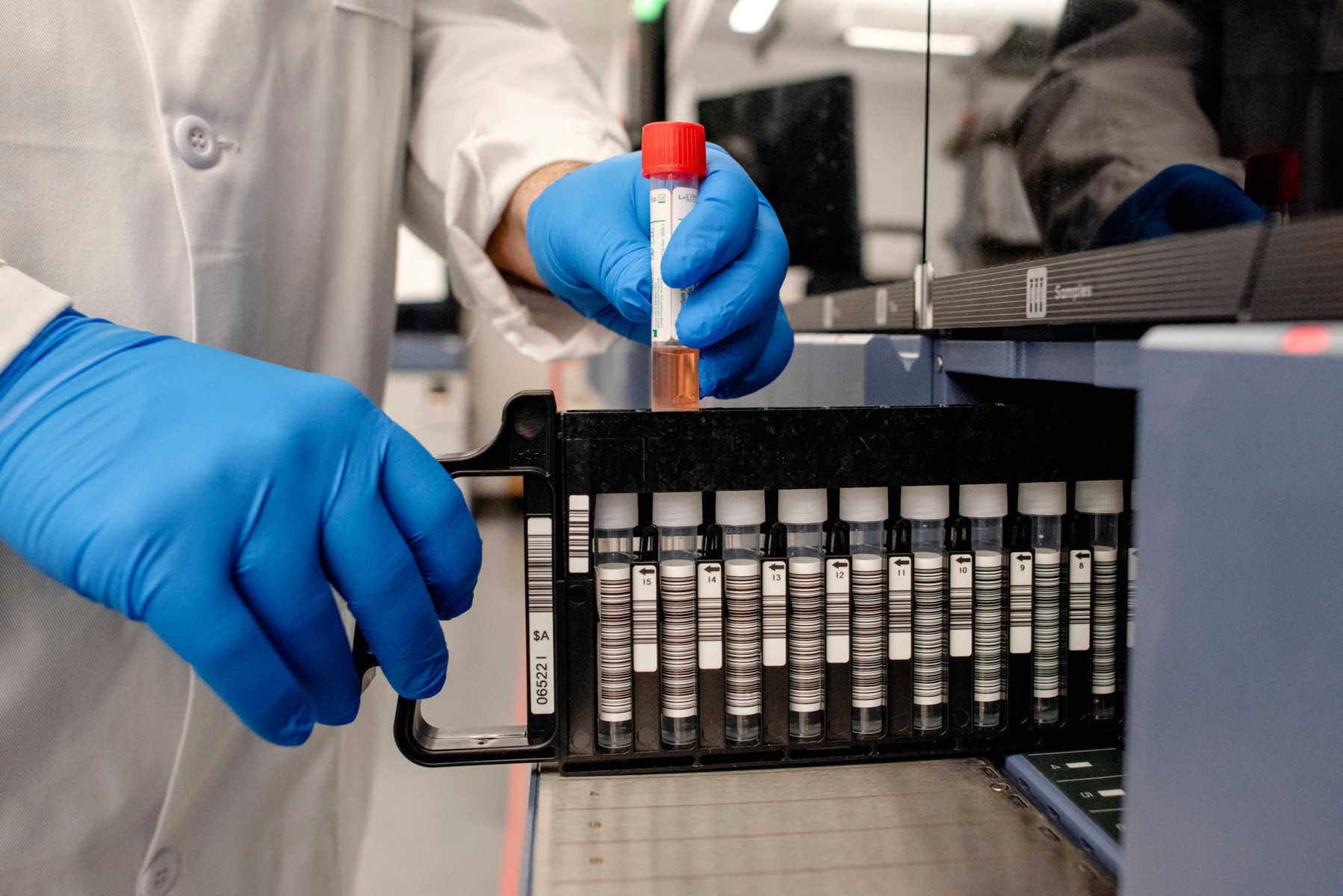 Coronavirus Covid-19 testing labs are under huge strain