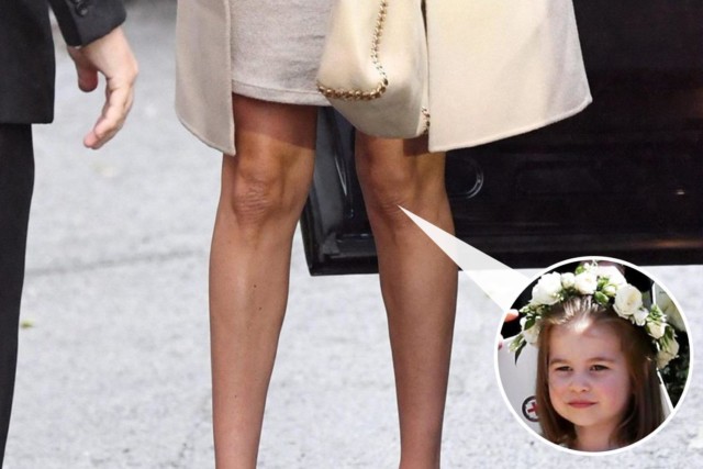  Meghan's left leg appears to show Princess Charlotte's sweet face