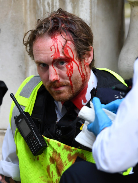 A police officer was left bleeding from his head after cops clashed with protesters in central London