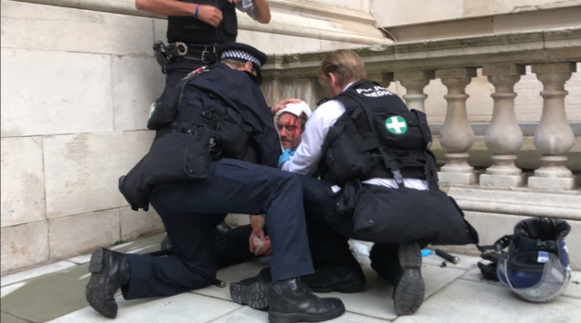 A cop was seen being treated by colleagues after suffering an injury on his head