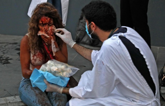 A bloodied woman after getting caught in the explosion