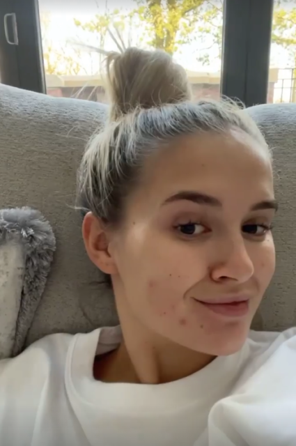 Molly-Mae Hague revealed she's suffering from a bout of acne
