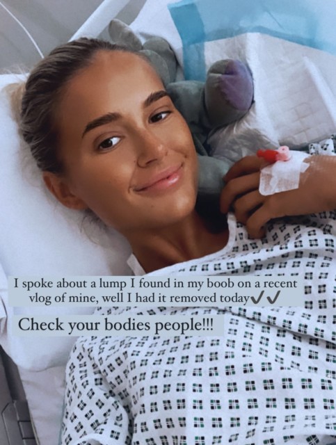 Molly-Mae Hague has recently had a lump from her breast removed